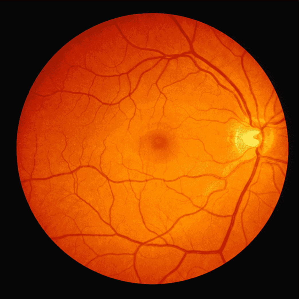 Retinal imaging scan